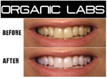 Load image into Gallery viewer, Organic Labs Activated Charcoal Teeth Whitening Set
