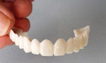 Load image into Gallery viewer, Ez Clip Veneers -Amazing &amp; Perfect Smile True Clip On
